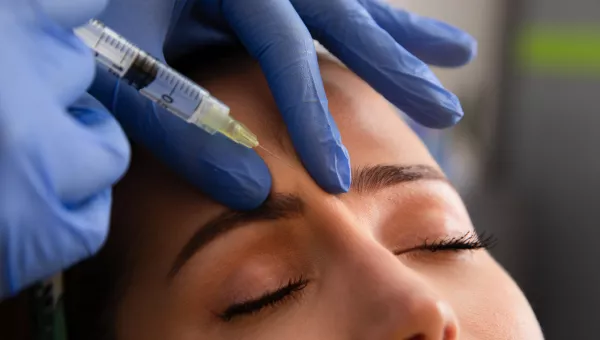 Brow Lift patient