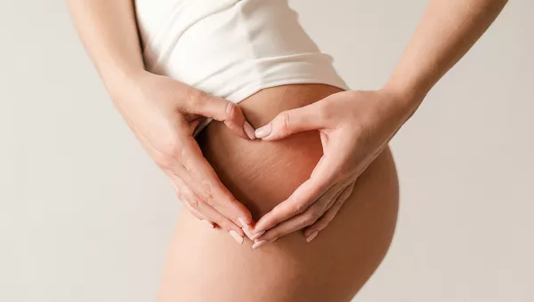 Cellulite Treatment patient