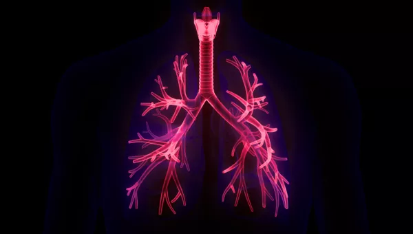 Sarcoidosis image